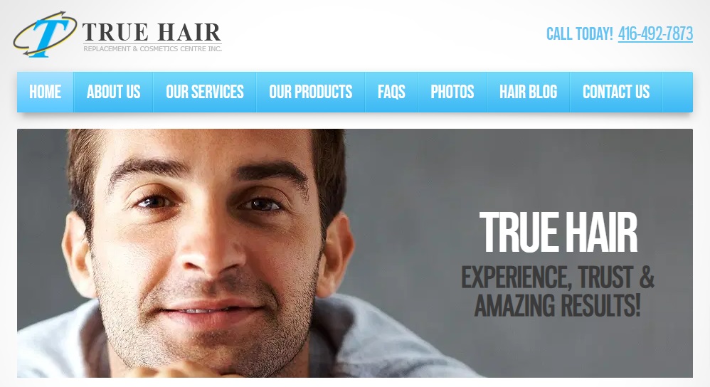 non-surgical hair replacement services in Toronto