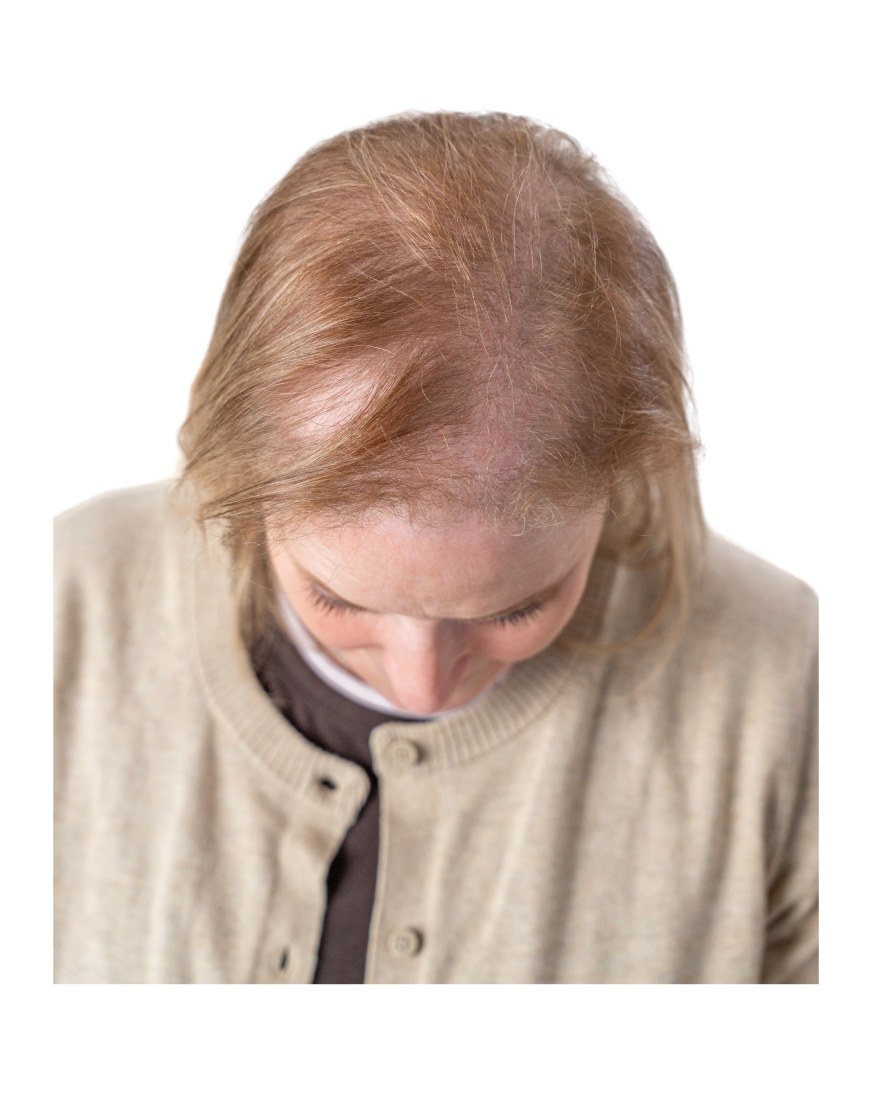 Before wearing a topper