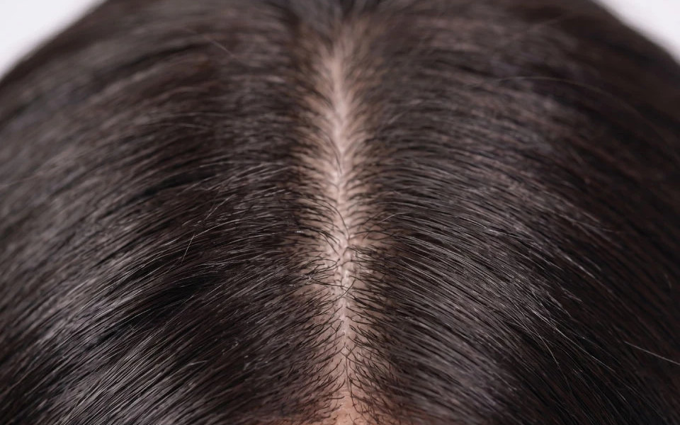 Part line close-up — lace blending at the scalp